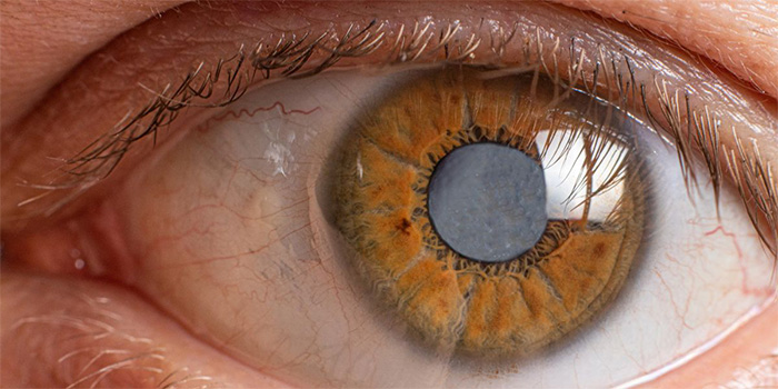 eye-glaucoma-diabetes-300px.jpg