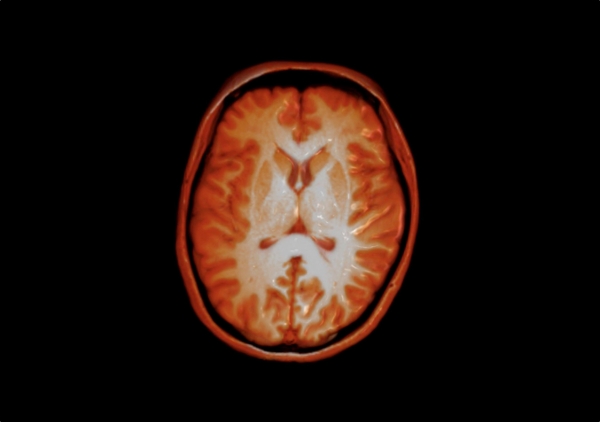 human-brain-mri-modified-wellcome.jpg